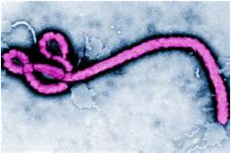This is an enlarged image of the ebola virus raging across West Africa. Photo courtesy of examiner.com.